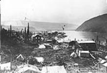 Dawson City, [Y.T.] looking south, showing Hospital Buildings. [1898-99.]