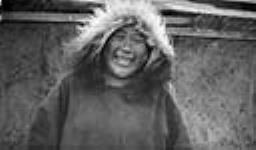 Koodluch, an Inuit man, before an operation 1931