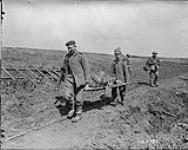 Bringing in our wounded. - Vimy Ridge. April, 1917 Apr., 1917