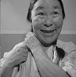 Mary Edetoak, a patient, who still has traditional Inuit tattoos. 1958.