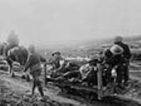 Wounded Canadian soldiers en route to a dressing station via light railway Septembre 1916