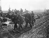 German prisoners bringing in wounded. Advance East of Arras. October, 1918 1914-1919