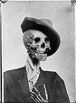 Skeleton studies - "The Tough", 20 Nov., 1910 20 Nov. 1910