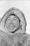 [Kaviok whose nose had been frost bitten.] 1949-1950